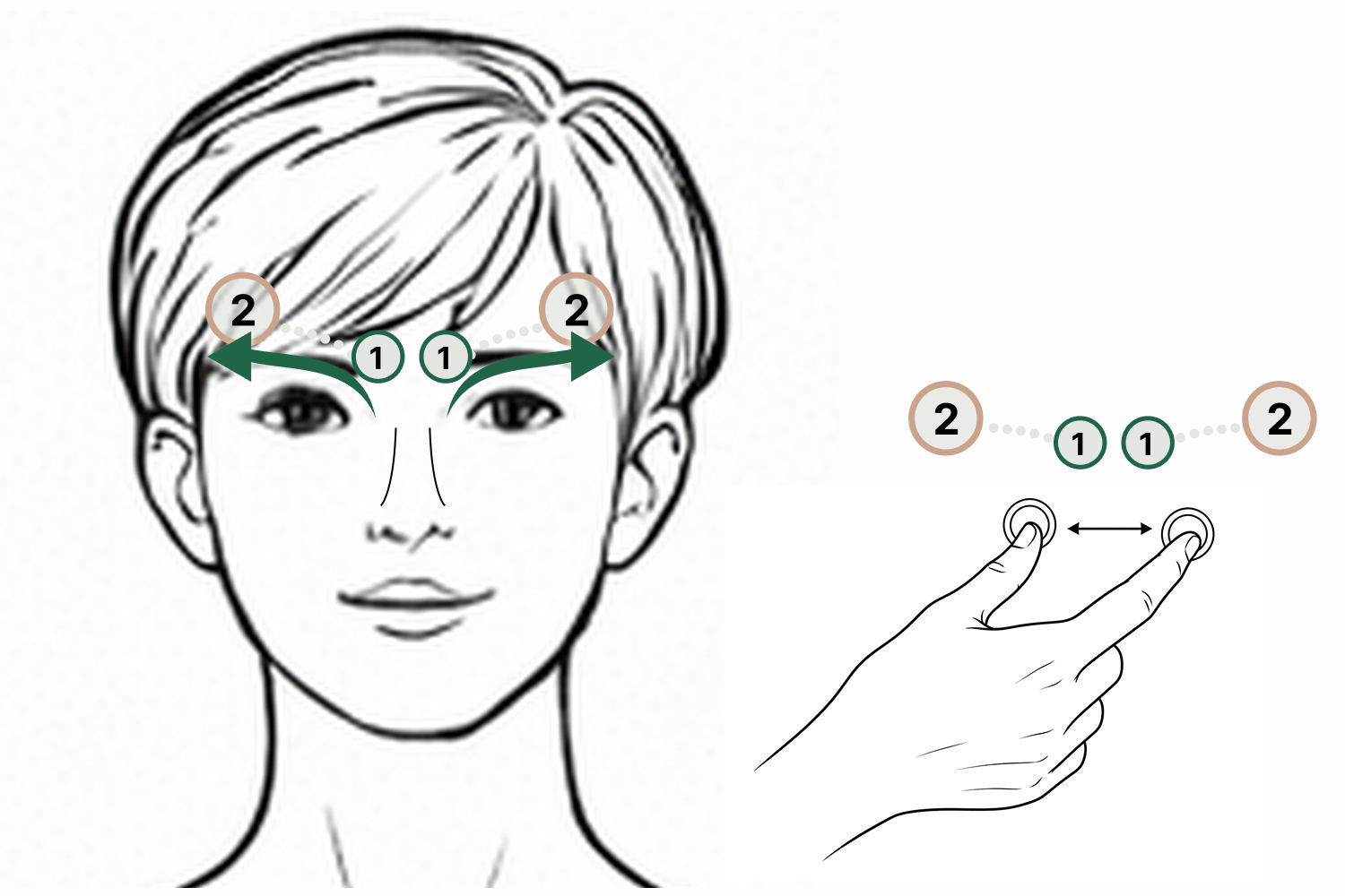 Illustration showing eyebrow pinching technique with fingers, with arrows pointing outward from inner to outer brow toward the peri-auricular nodes