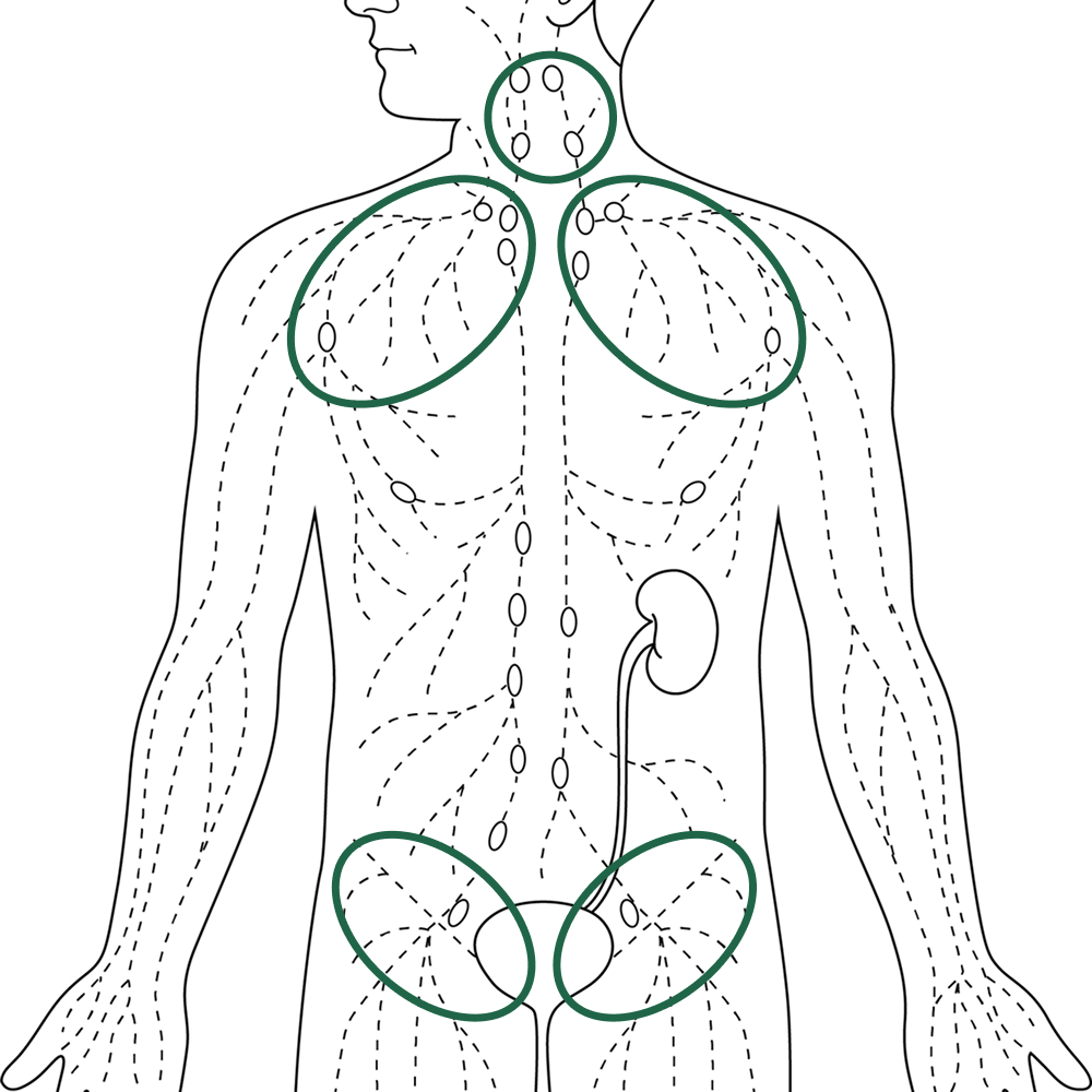 Diagram of the lymphatic system showing major node clusters at the neck, underarms and groin